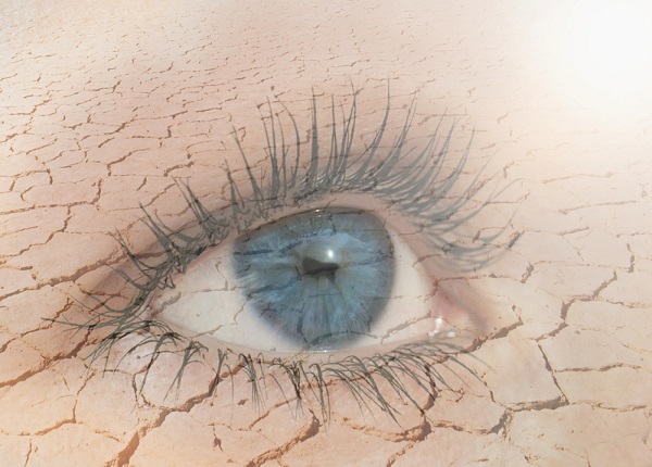 Khô mắt có thể gây ra tình trạng mắt bị đau nhức