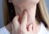 Nhân xơ tuyến giáp khiến cổ phình to, mất cân đối