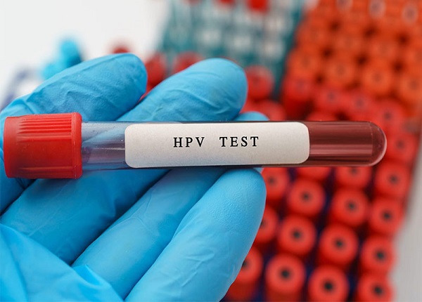 Virus HPV là nguyên nhân chính gây ung thư cổ tử cung